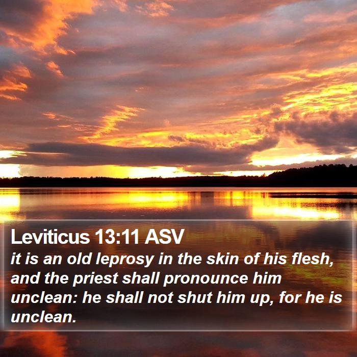 Leviticus 13:11 ASV Bible Study