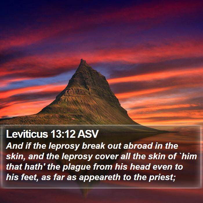 Leviticus 13:12 ASV Bible Study