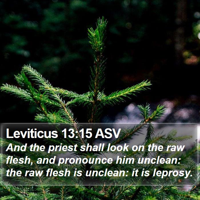 Leviticus 13:15 ASV Bible Study