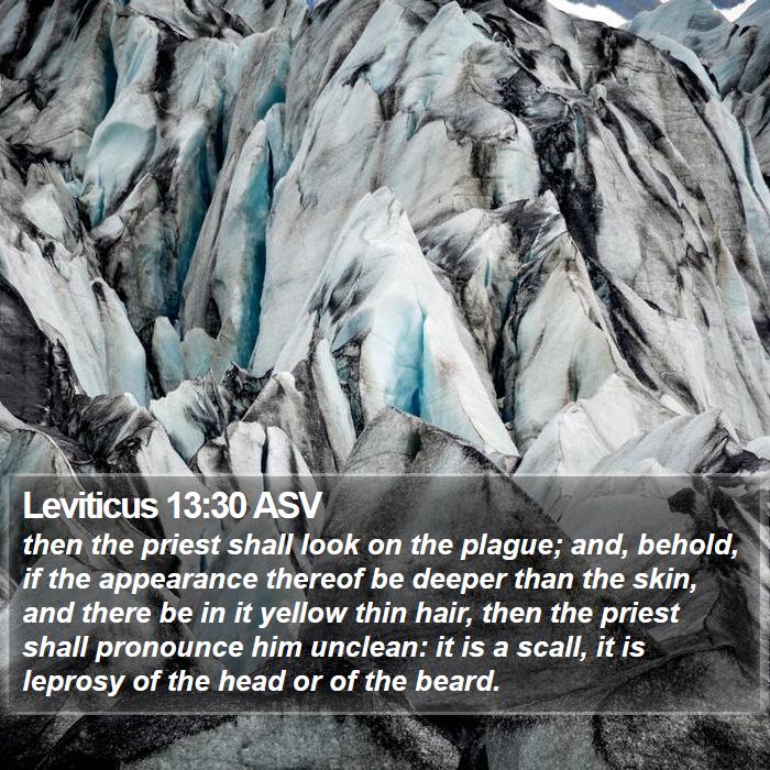 Leviticus 13:30 ASV Bible Study