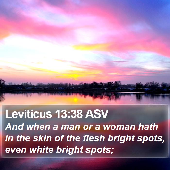 Leviticus 13:38 ASV Bible Study