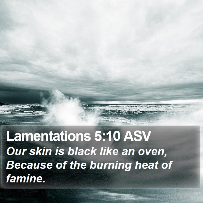 Lamentations 5:10 ASV Bible Study